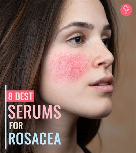 best calming serum for rosacea.